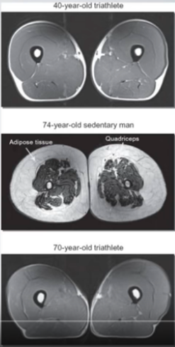 Effects of strength training for health and longevity and muscle mass