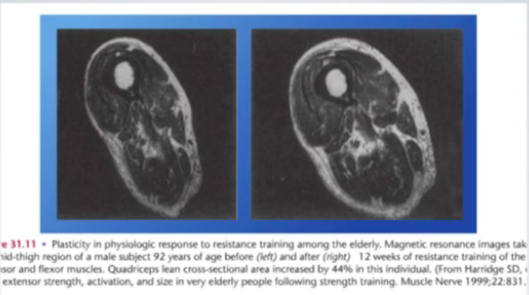 Effects of strength training for health and longevity and bone density